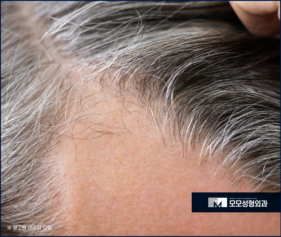 검은콩흰머리 효능에 대해 궁금하다면 관련 이미지 4