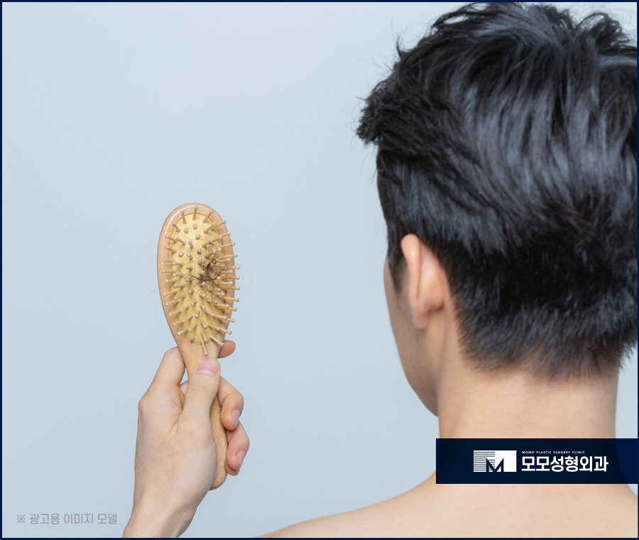 대량모발이식 후회 없는 선택으로 관련 이미지 3