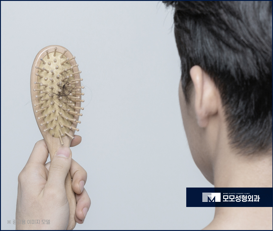 모발이식2000모 자연스럽게 채우는 방향으로 관련 이미지 3