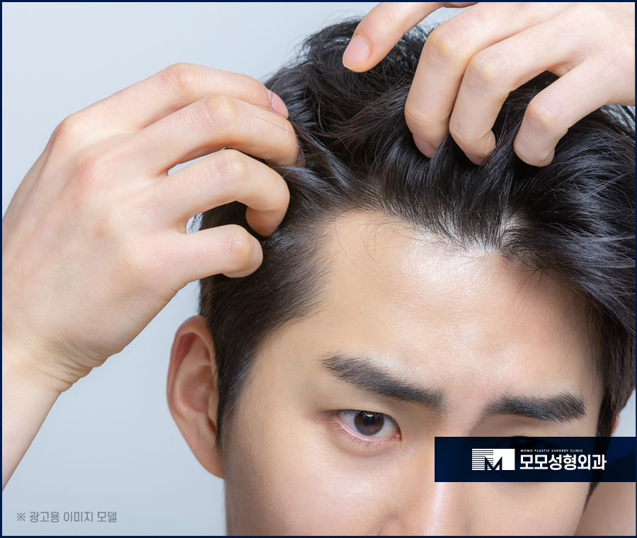 지루성두피염증상 어떤 것들이 있는지 관련 이미지 6