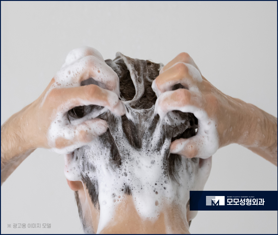 두피모낭염증상 원인을 알고 대처하는 관련 이미지 6