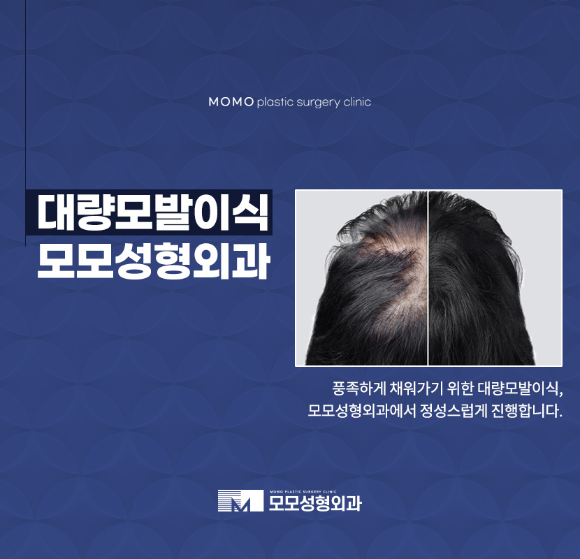 대량모발이식 부족하지 않게 채워가는 방향으로 관련 이미지 1