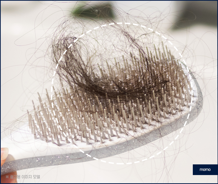 압구정 모발이식 건강한 두피를 만드는 방법 관련 이미지 4