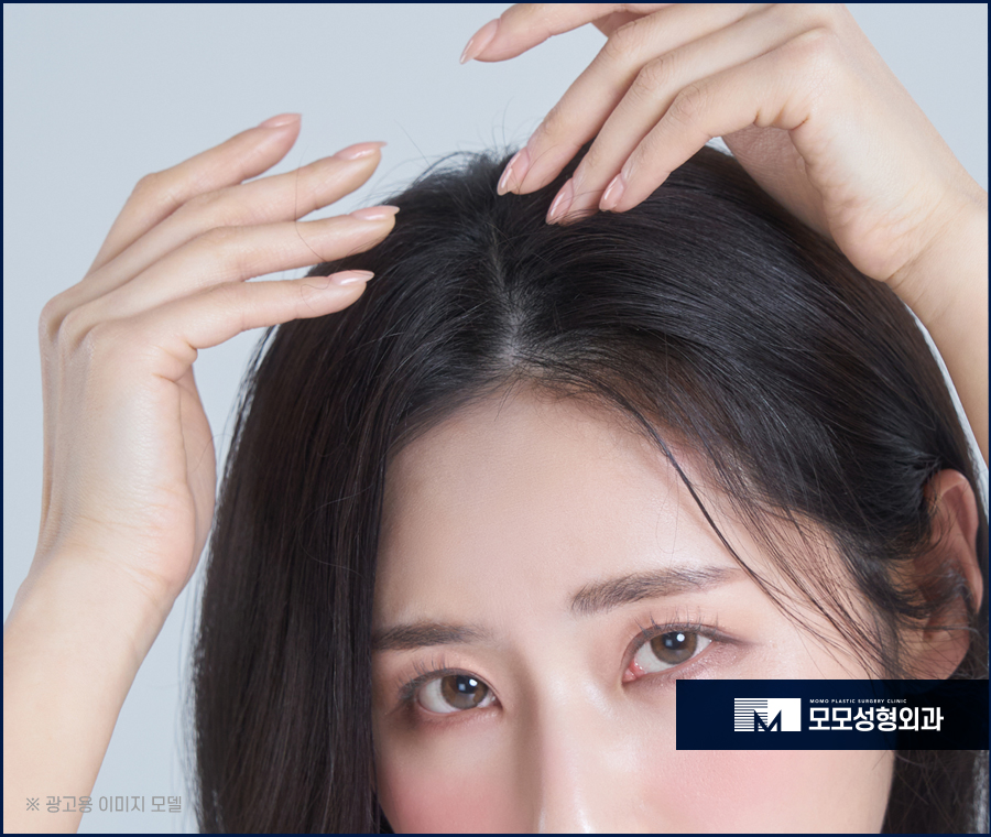여자M자탈모 사전 예방법부터 발생 시 대처하는 방법 관련 이미지 3