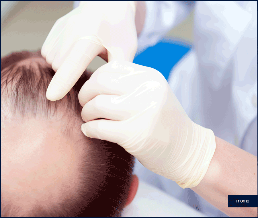 탈모 클리닉 비용의 기준이 되는 조건은? 관련 이미지 10