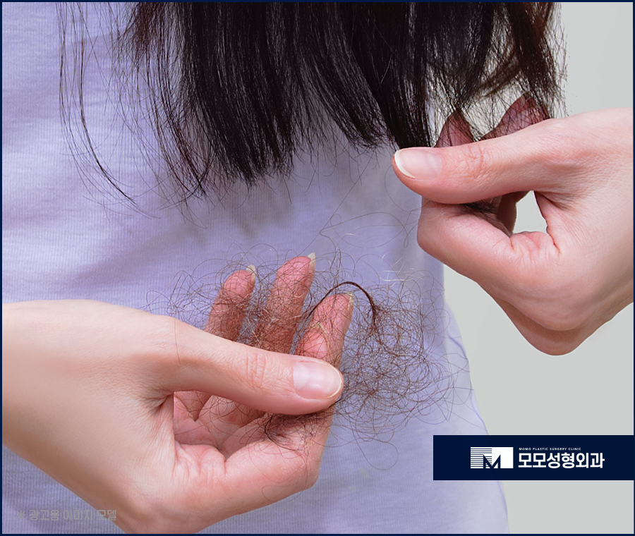 미녹시딜부작용 미리 알고 올바르게 관련 이미지 2