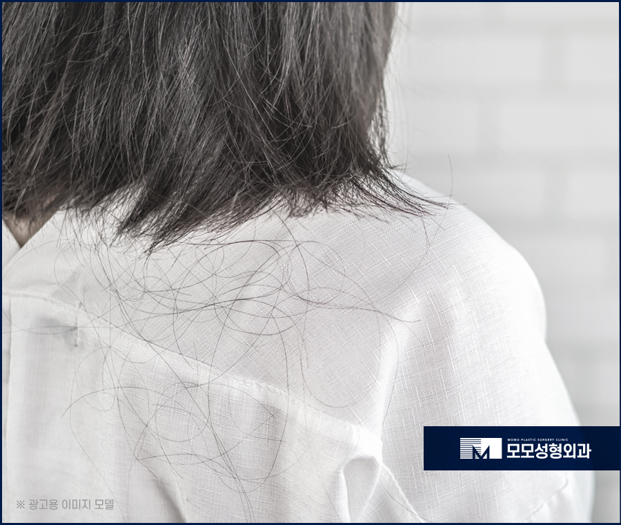 비절개모발이식비용을 기준하는 요건은 관련 이미지 3