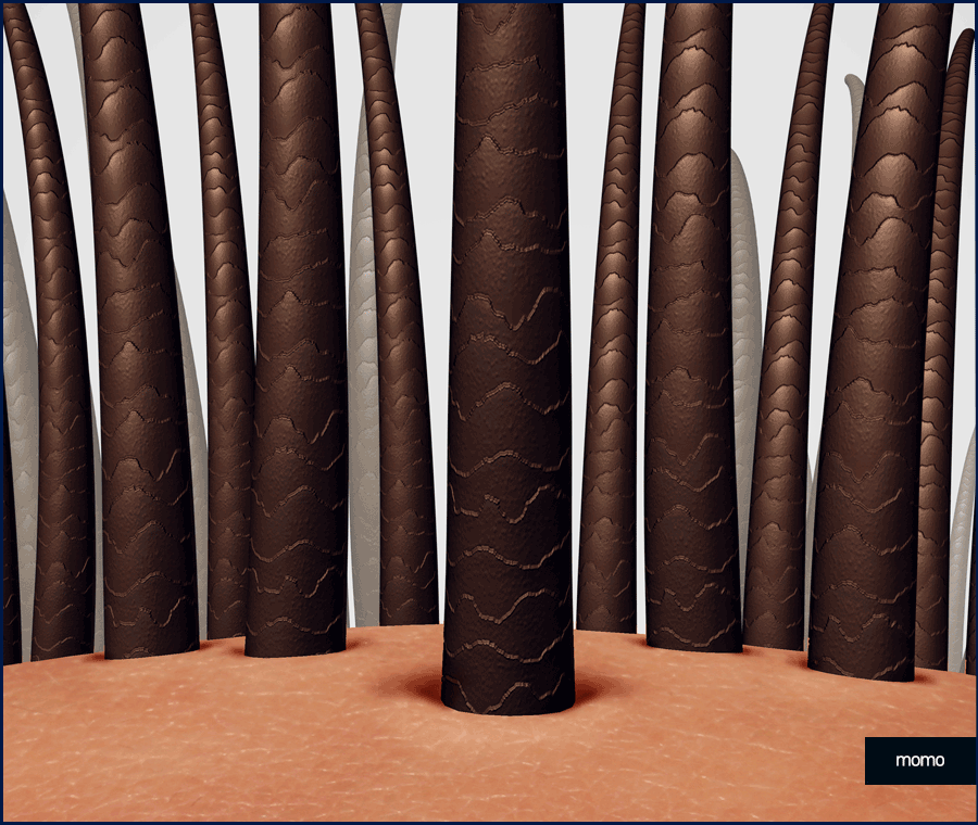 강남 모발이식 성공적인 변화를 만드는 꿀팁 관련 이미지 4