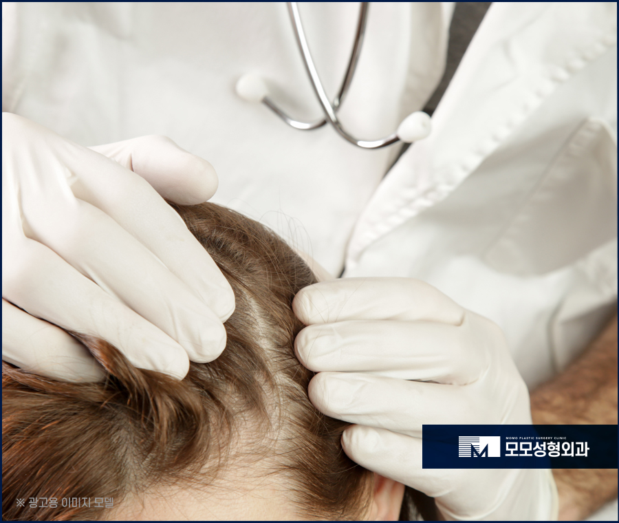 바르는탈모약 효과를 톡톡히 보길 원한다면 관련 이미지 6