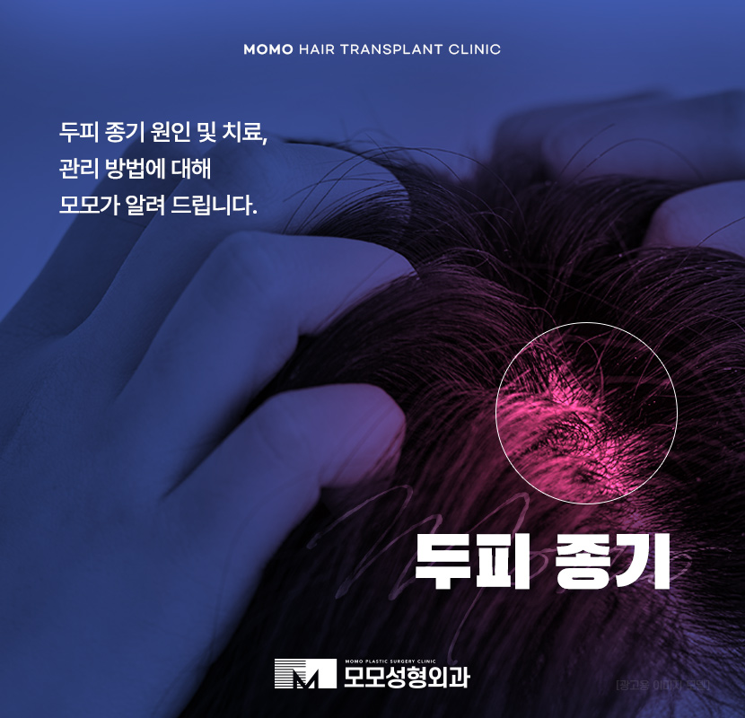두피 종기 원인 및 치료, 관리 방법 관련 이미지 1
