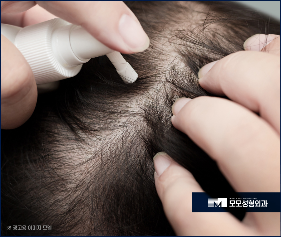 M자탈모약 효과적인 예후를 이뤄가는 관련 이미지 8