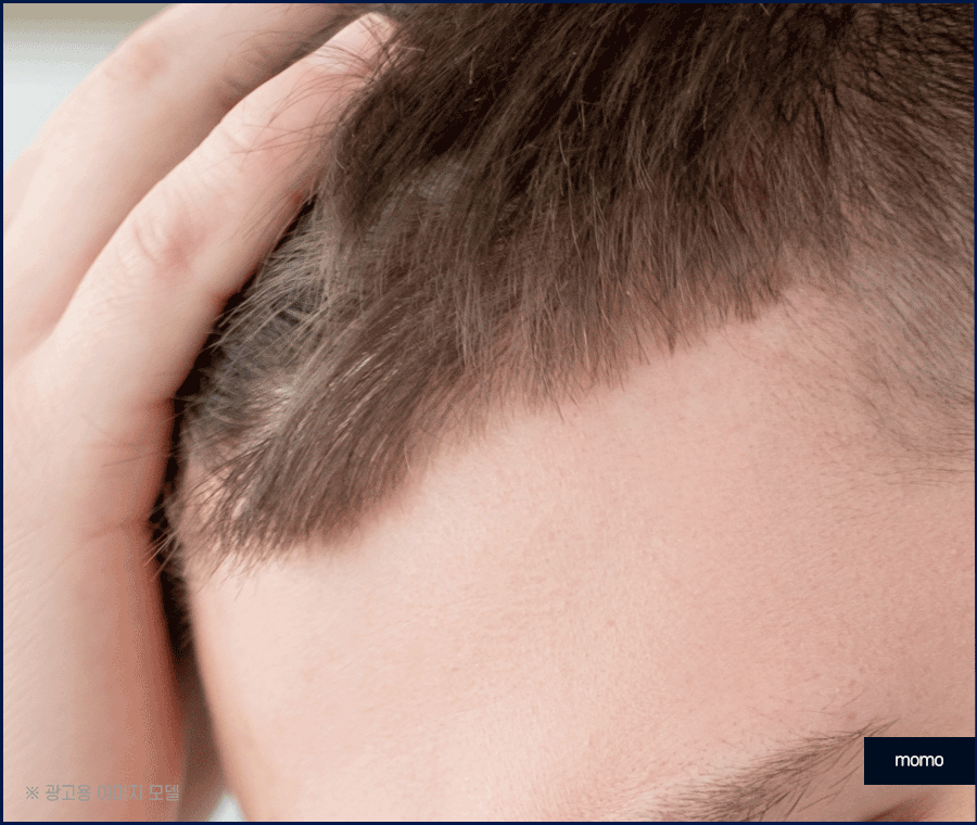 탈모약 복용시간의 중요성 및 주의사항 정리 관련 이미지 6