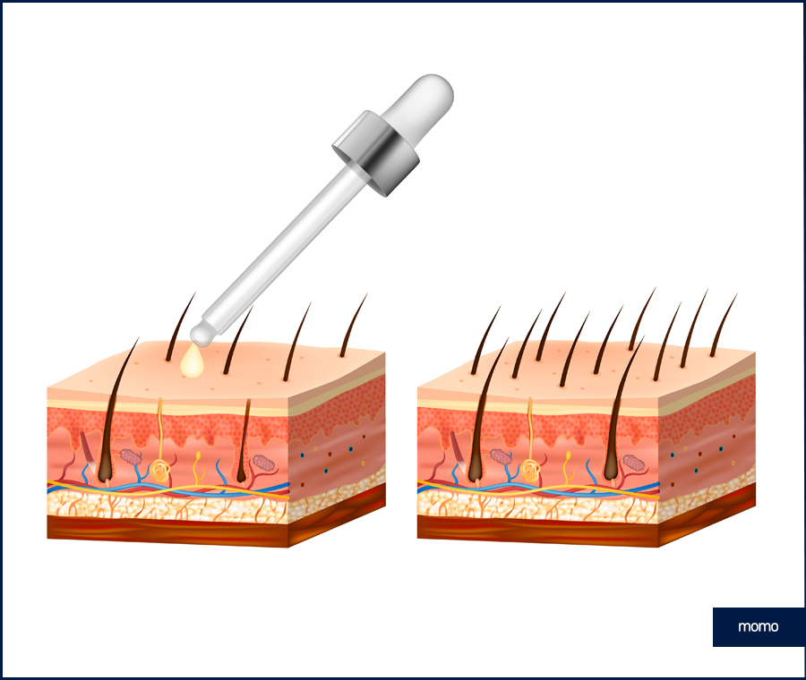 탈모약 부작용 증상 및 주의해야 할 사항 관련 이미지 11