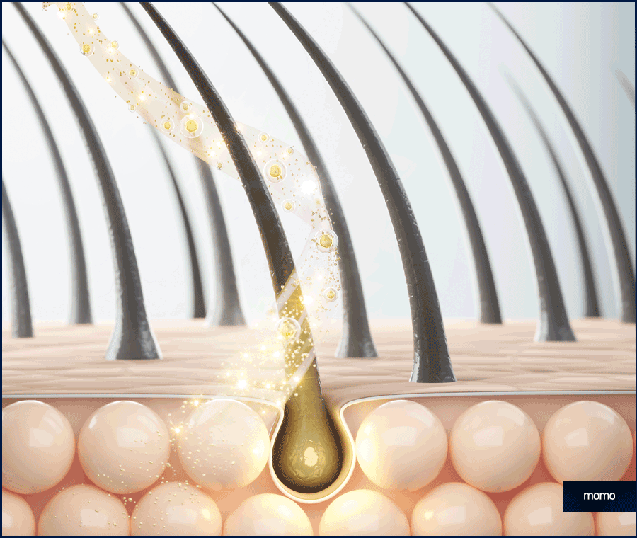 남자 모발이식 비용, 방법까지 꼼꼼히 확인하세요! 관련 이미지 2