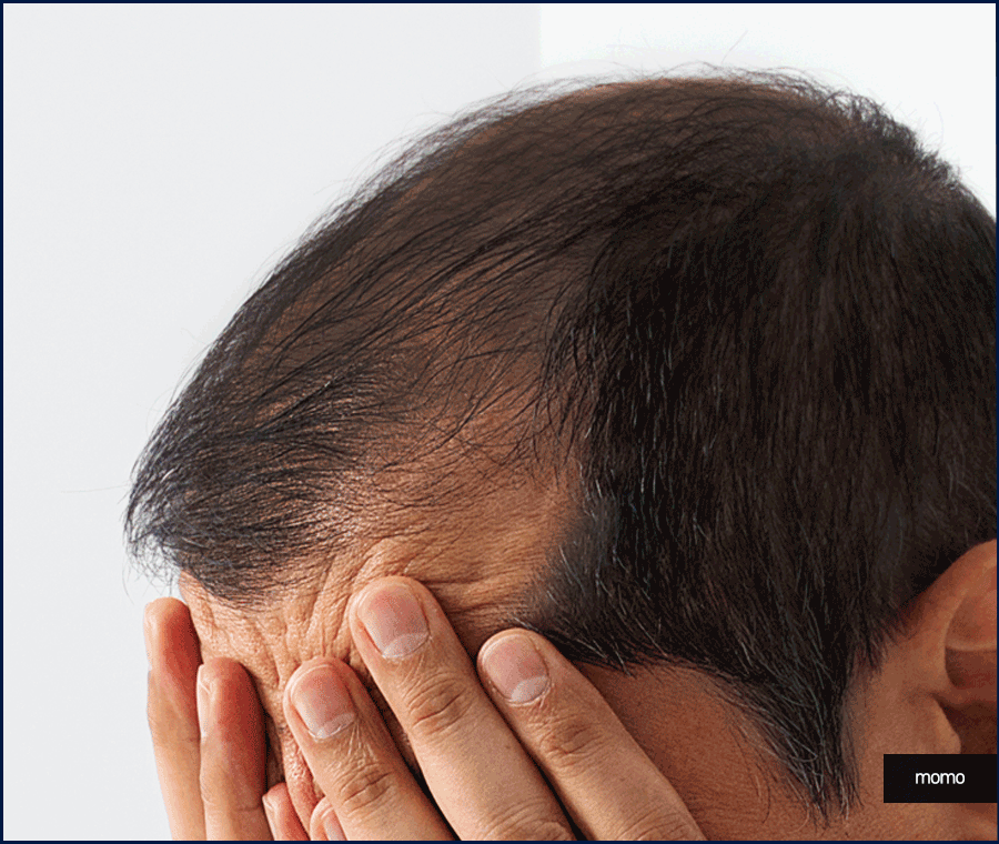 탈모약 처방 병원 꼼꼼한 진단하는 곳을 찾는다면 관련 이미지 2