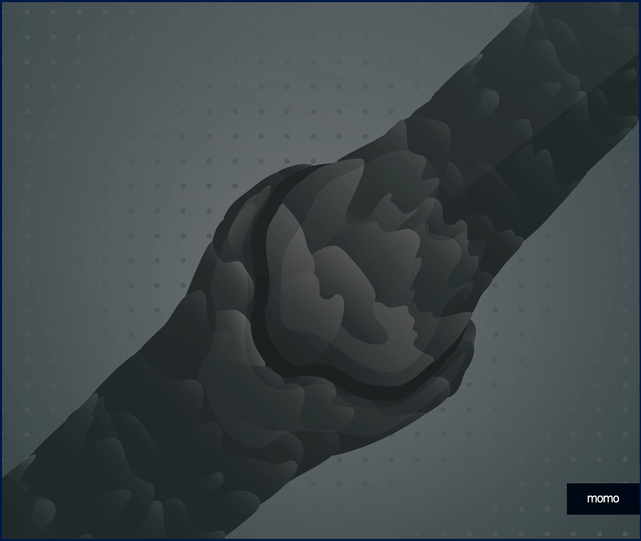 엠자 탈모 섬세하게 채워 만드는 변화 관련 이미지 4