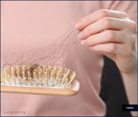 여성 모발이식 자연스러운 변화를 만드는 관련 이미지 4