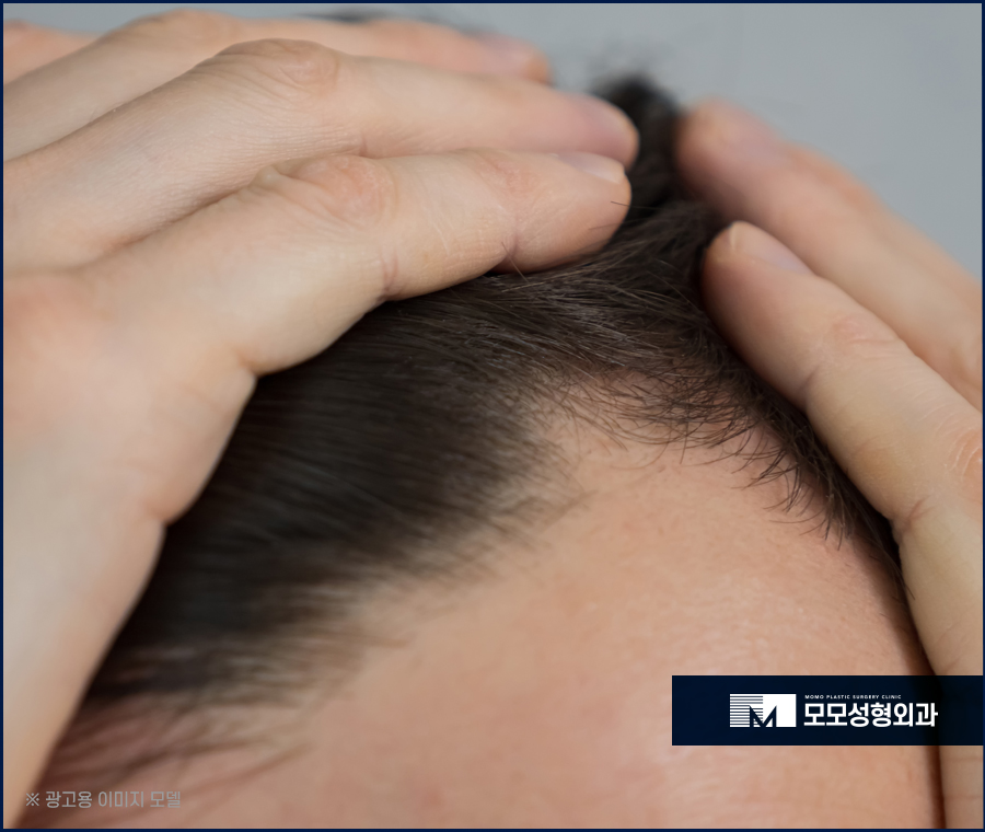 여자헤어라인교정 라인을 맞춰 아름다움을 높이는 관련 이미지 2