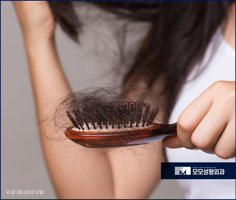 스트레스성탈모증상 다양하게 나뉘어 지는 관련 이미지 5