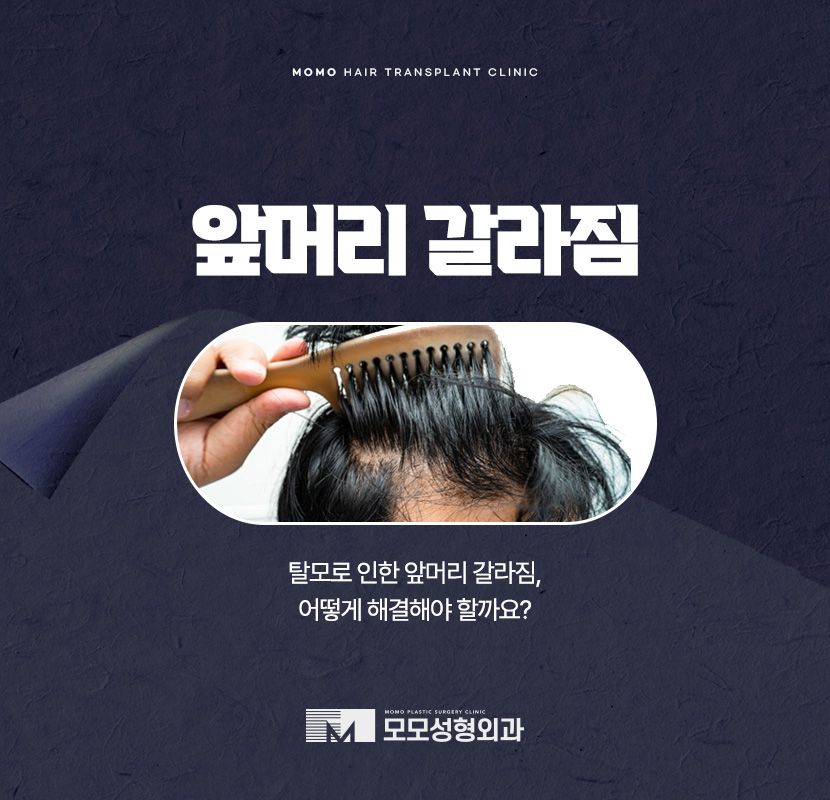 앞머리갈라짐 탈모 해결 방법까지 알아 보는 관련 이미지 1