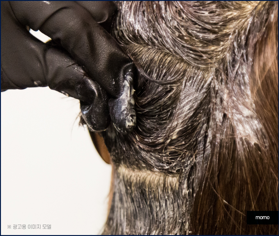 모발이식 후 염색 언제쯤 하는게 좋을까요 관련 이미지 9