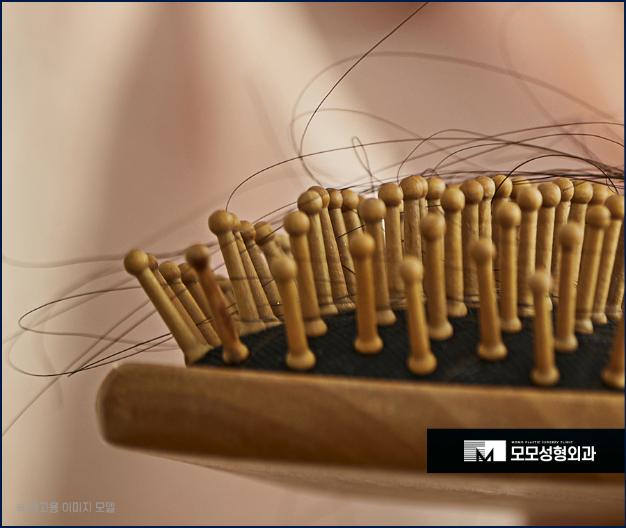 여자비절개모발이식 이질감없는 자연스러움으로 관련 이미지 2