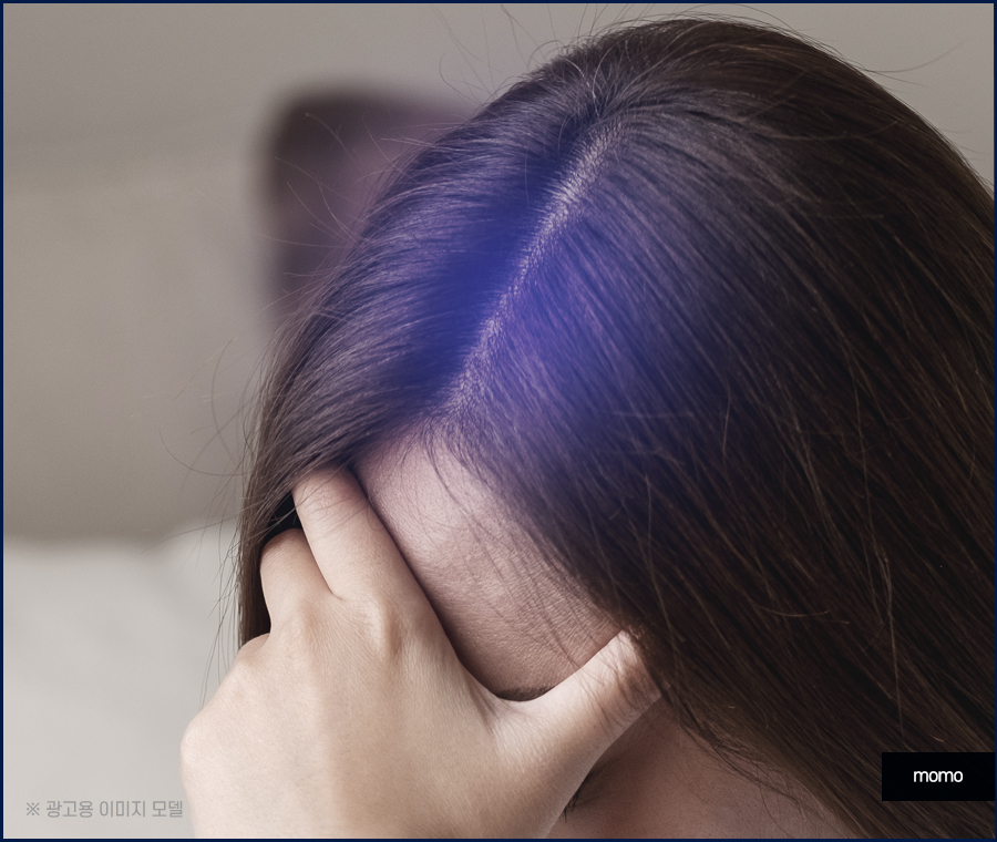 모발이식재수술 원인 파악을 먼저 관련 이미지 3