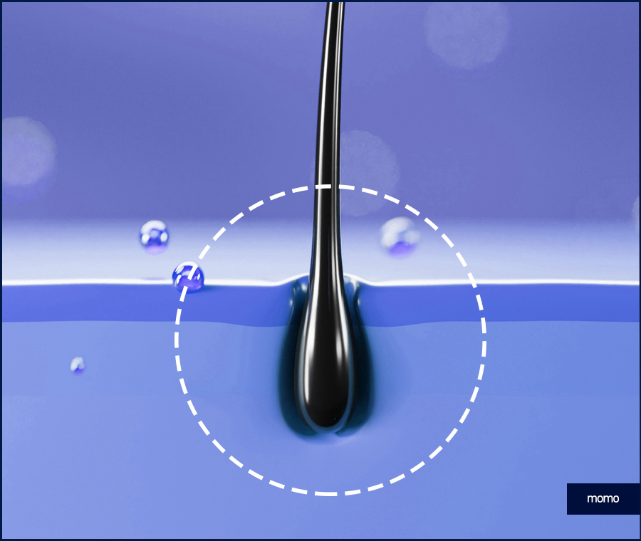 두피가 아파요 증상 원인과 해결하는 방안은 관련 이미지 8
