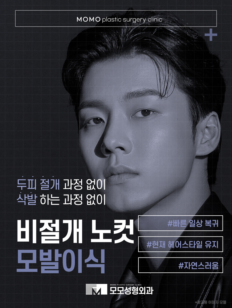 m자탈모초기증상 면밀하게 관찰해야 하는 이유 관련 이미지 9