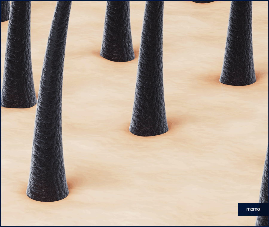 모발이식전후 확인 중이라면 꼭 체크할 핵심 요소 관련 이미지 4