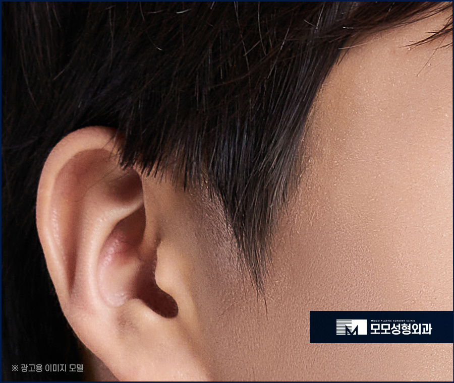 남자 옆머리 탈모 구레나룻의 양이 부족하다고 느껴질 경우엔 관련 이미지 8