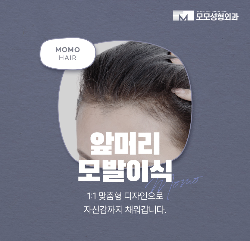 앞머리 모발이식 비용 개인에 따라 달라지는 이유 관련 이미지 1