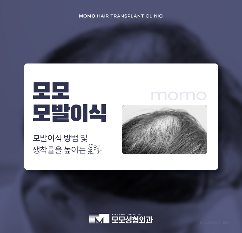 압구정역 모발이식 방법 및 생착률을 높이는 팁 관련 이미지 1