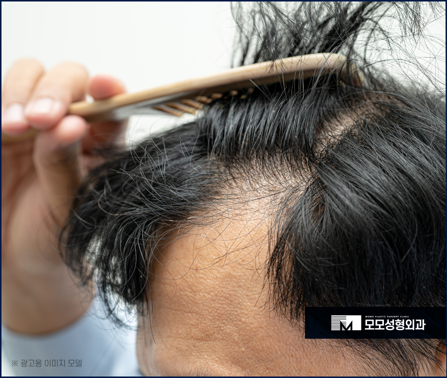 강남역탈모병원 풍성한 모습을 완성하기 위한 곳 관련 이미지 4