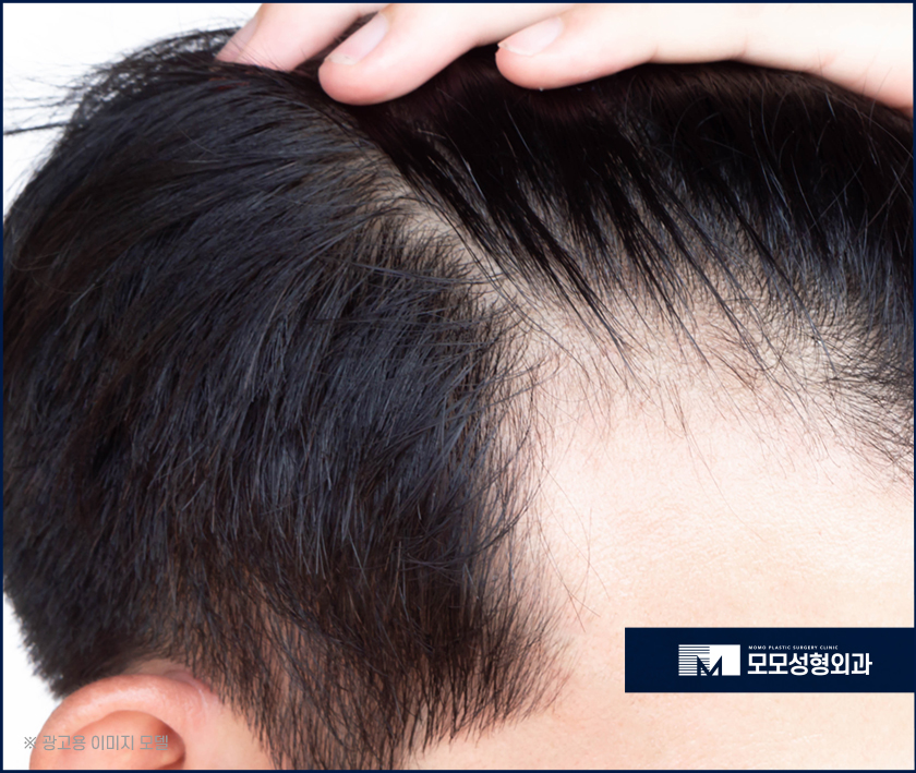 엠자이마를 그대로 두지 말아야하는 원인은 관련 이미지 4