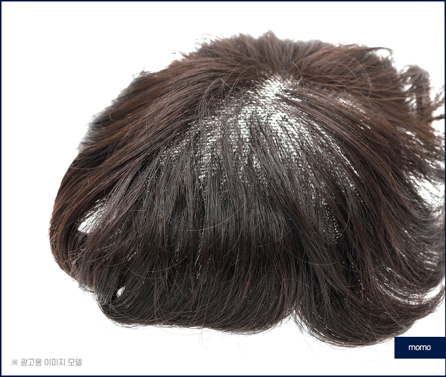 앞머리 모발이식 가격 차이부터 확인하며 관련 이미지 4