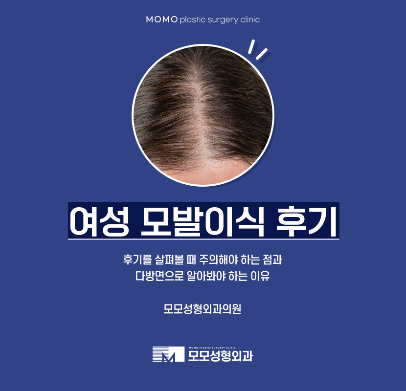 여자모발이식후기 다양하게 비교해 보아야만 관련 이미지 1