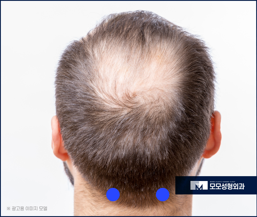 두피마사지법 증세에 효과적인 관련 이미지 5