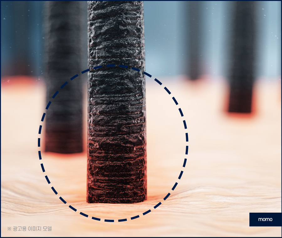 머리카락 얇아짐 발생하는 이유부터 회복 방안 관련 이미지 7