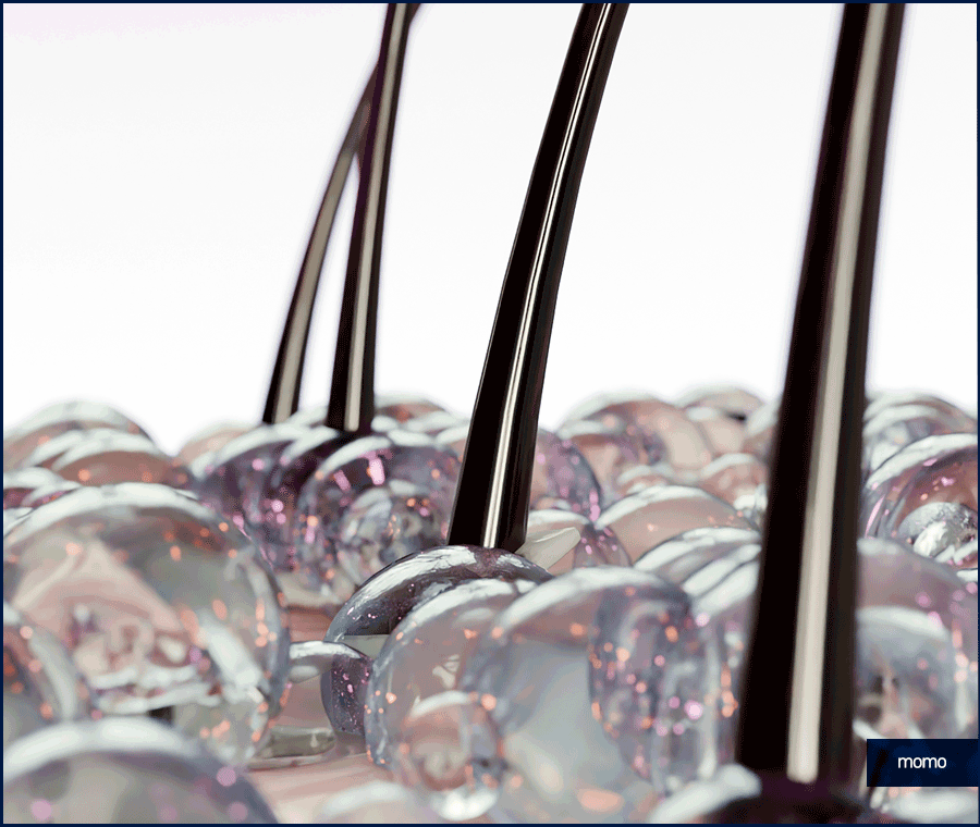 압구정 탈모병원 보완을 위한 최선책은? 관련 이미지 11