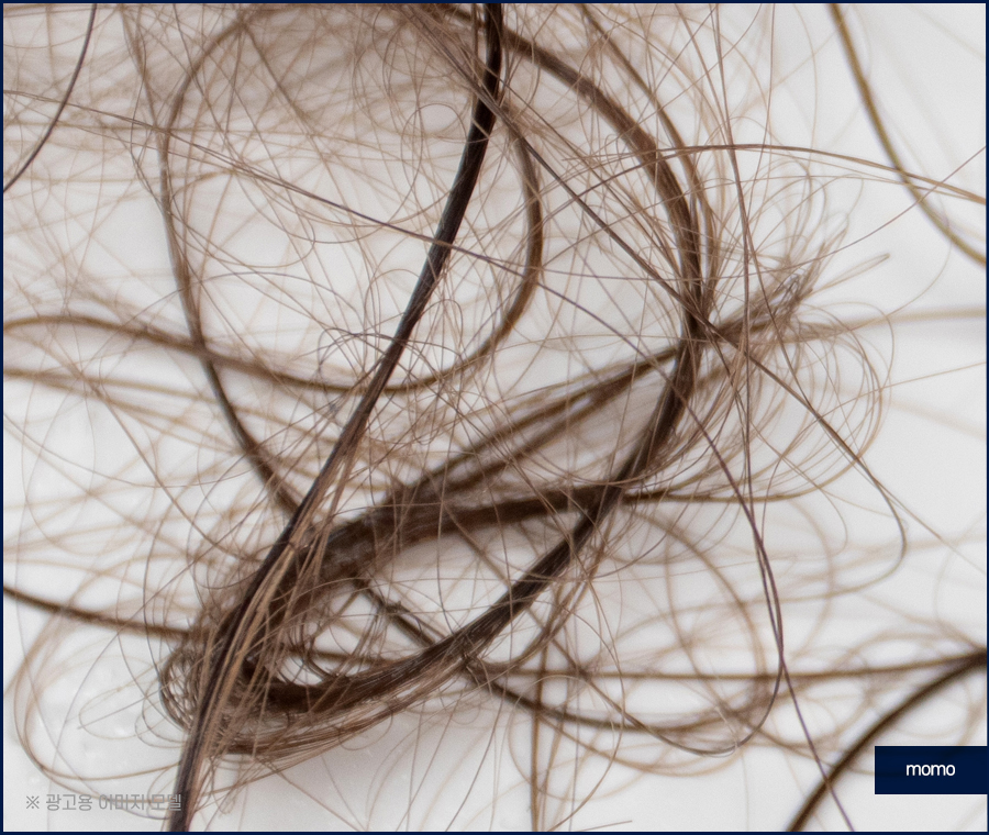 압구정 모발이식 건강한 두피를 만드는 방법 관련 이미지 5