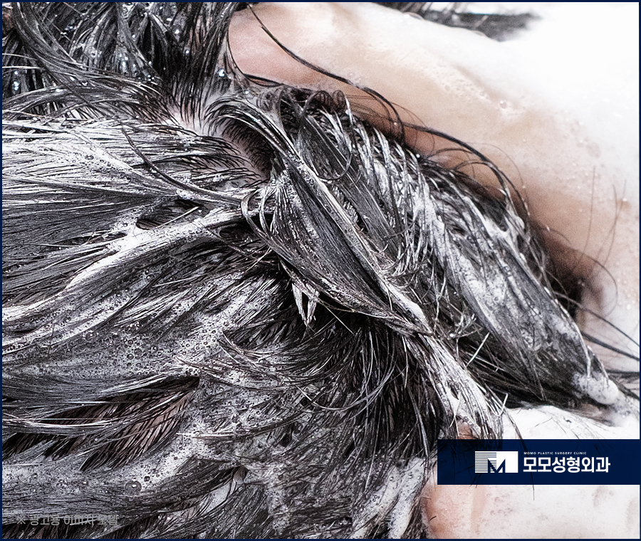 앞머리갈라짐 탈모 해결 방법까지 알아 보는 관련 이미지 6