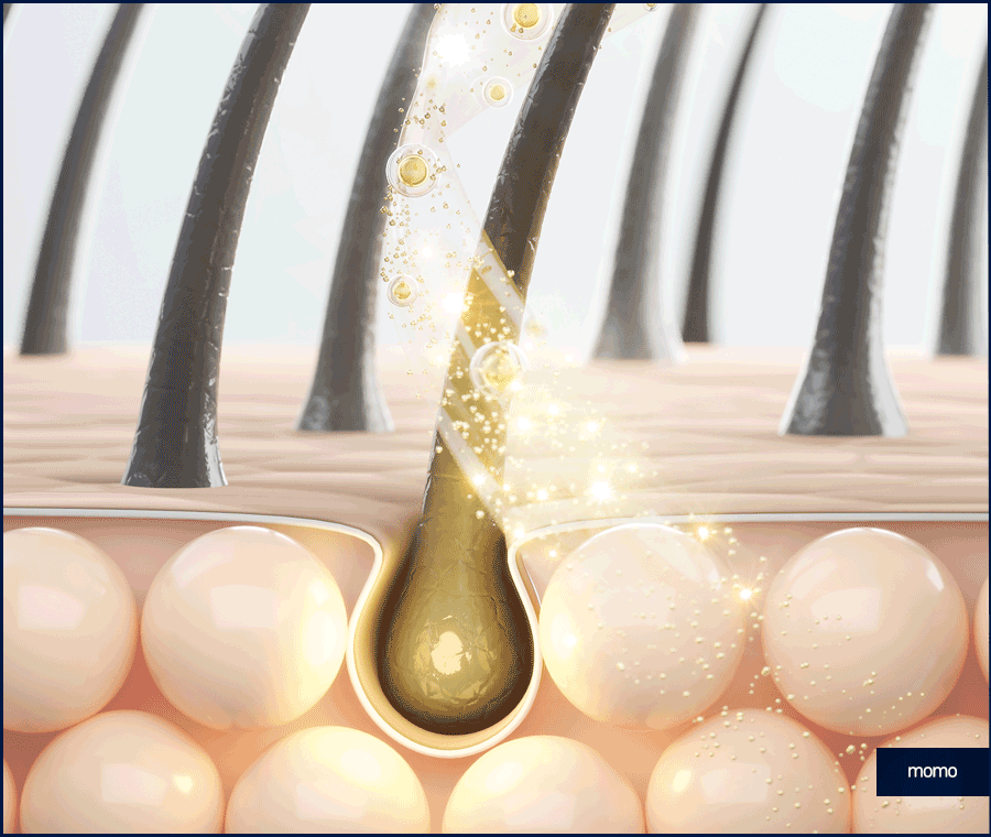 머리심기 비용 및 시술별 장단점 알아보기 관련 이미지 4