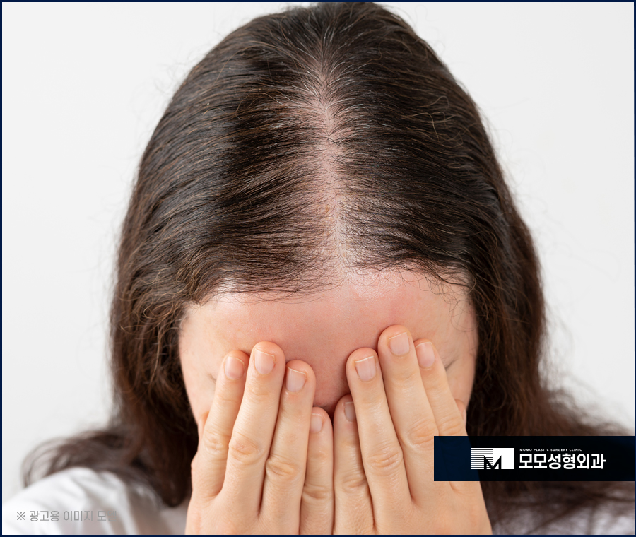 여성 정수리 모발이식 섬세한 집도가 중요한 이유 관련 이미지 2