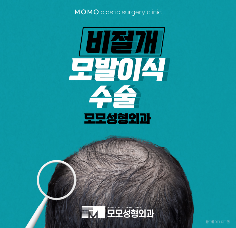 비절개모발이식수술 후회 없는 결과 관련 이미지 1