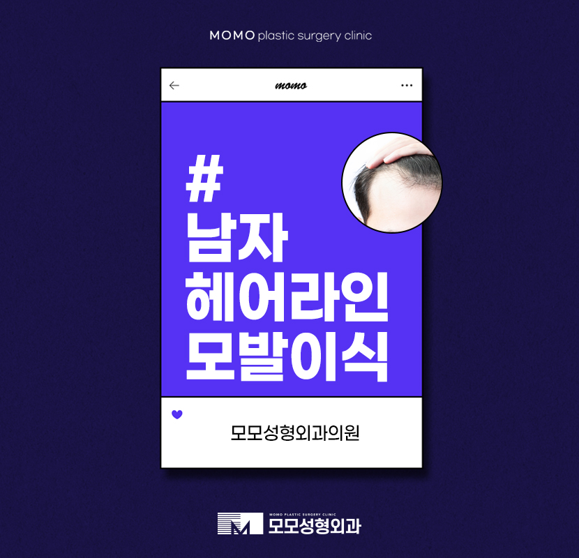 Male Hairline Hair Transplant: It Differs Depending on the Method image 1