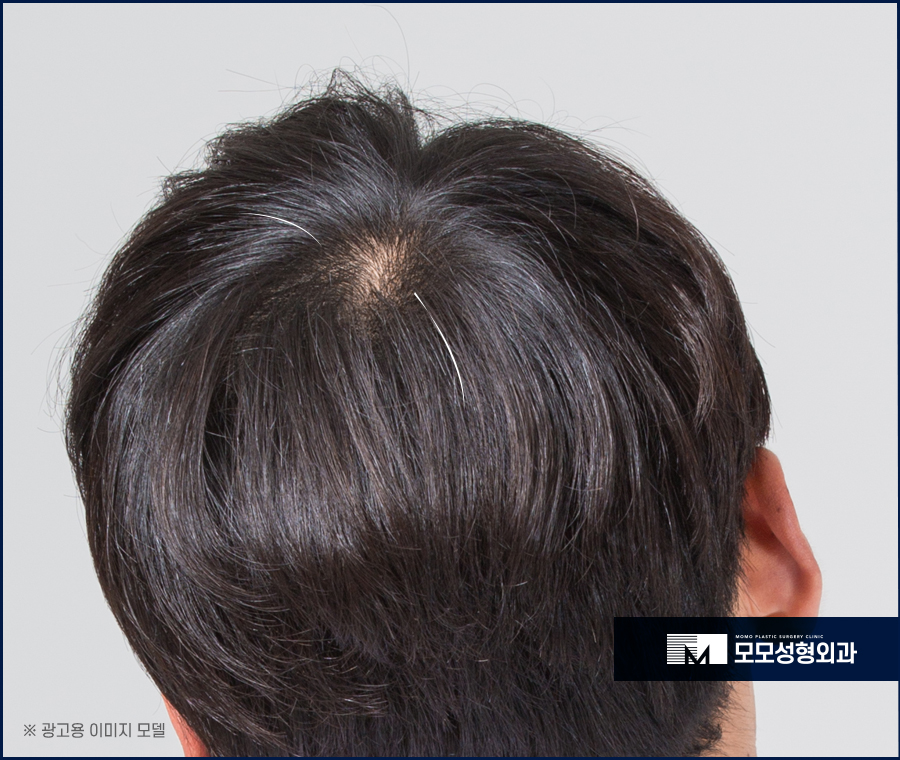 검은콩흰머리 효능에 대해 궁금하다면 관련 이미지 2