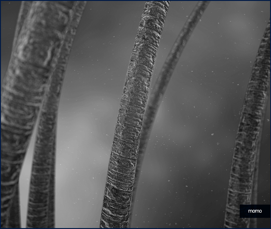 압구정 모발이식 세심한 사전 진단부터 시작하는 곳 관련 이미지 8