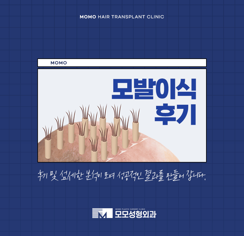 모발이식 후기 비교하며 섬세한 분석까지 해야만 관련 이미지 1