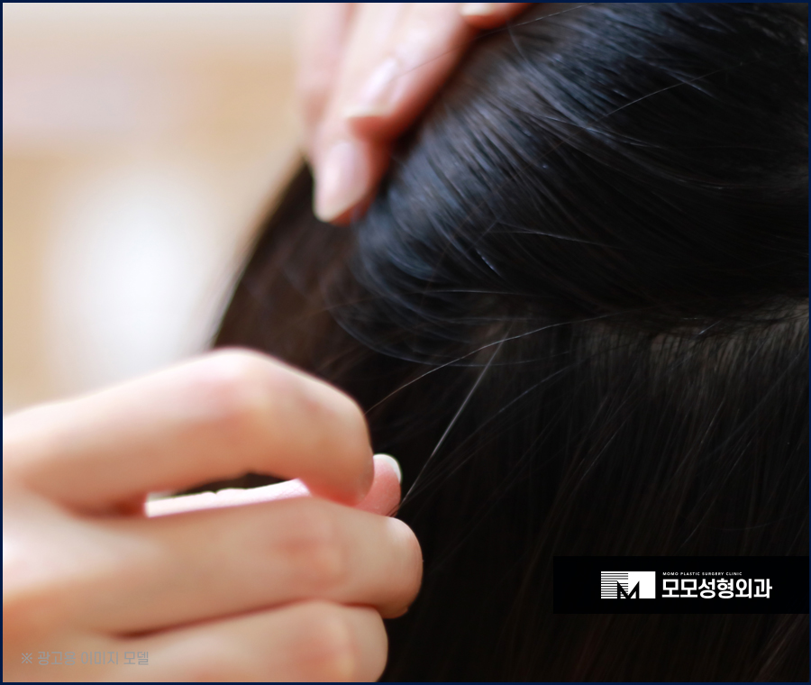 새치 뽑으면 생기는 문제 및 관리 방법까지 관련 이미지 4